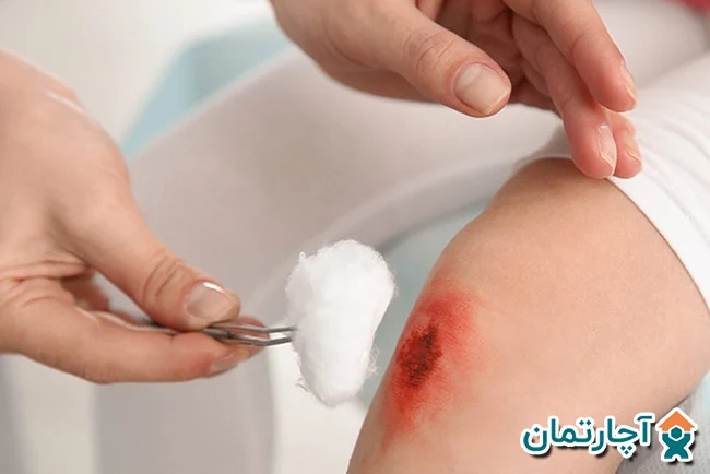 درمان زخم بستر