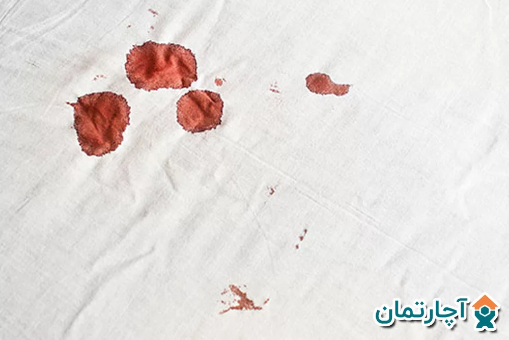 روش های خانگی از بین بردن لکه خون روی لباس
