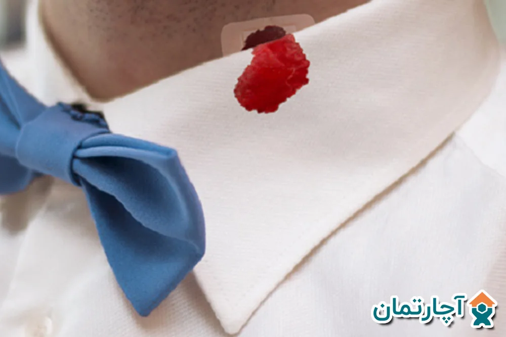 پاك كردن خون از لباس
